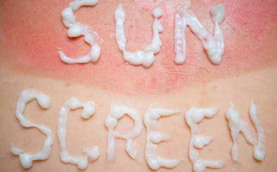 夏季曬傷不害怕 2種偏方去痛又消痕