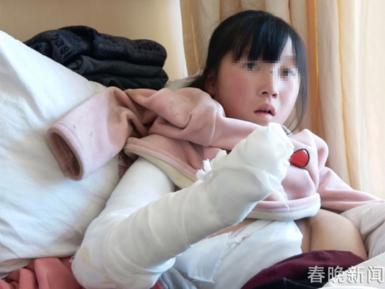 殘疾女孩火海中被燒焦