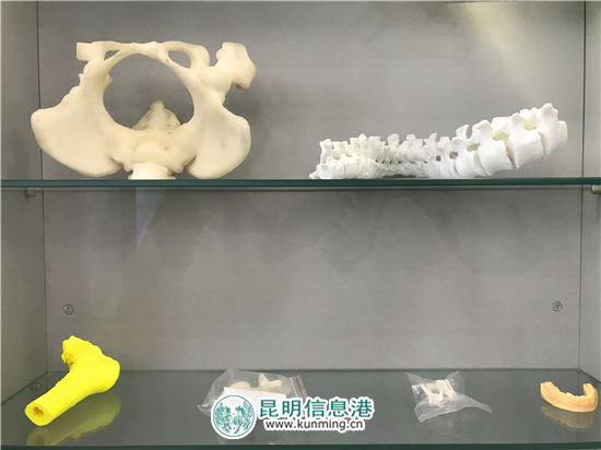 官渡區(qū)人民醫(yī)院“醫(yī)學(xué)3D打印運(yùn)用示范基地”正式揭牌