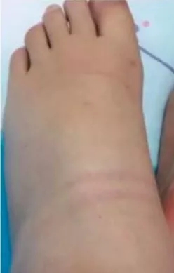 2天做25臺手術(shù) 婦科醫(yī)生自拍“大象腳”