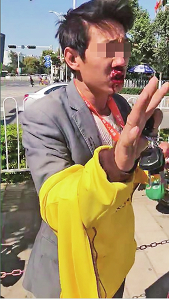 外賣小哥著急送餐亂停車 鼻骨被打折