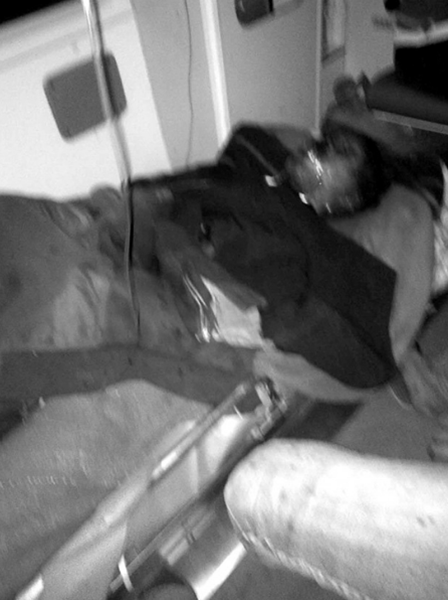 被燒傷的楊高飛