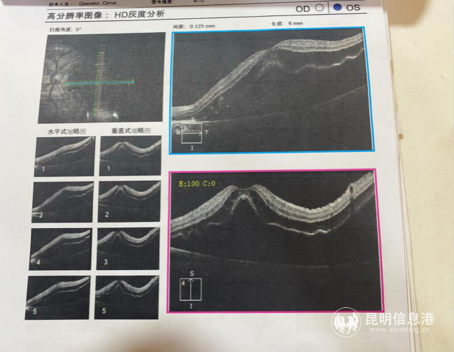 胡女士的檢查報告1 胡女士的檢查報告1