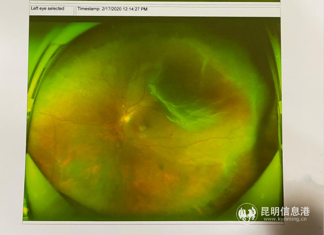 胡女士的檢查報告2 胡女士的檢查報告2