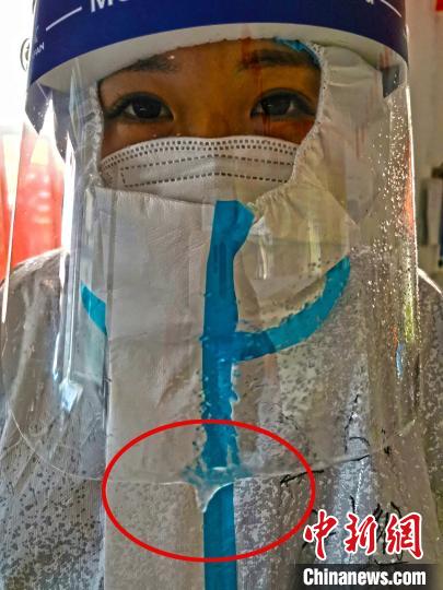 醫(yī)護(hù)人員長時間堅守在凜冽寒風(fēng)中，呼出的氣息在隔離面罩上結(jié)成了冰霜。圖片由陸軍軍醫(yī)大學(xué)士官學(xué)校附屬醫(yī)院提供