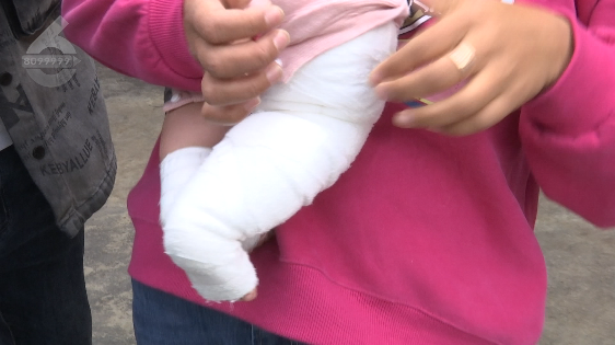 母嬰店洗澡，8月嬰兒被燙成二度燒傷