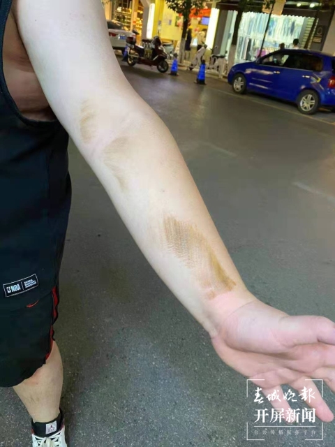 文化巷居然有個井蓋頻繁“咬”人