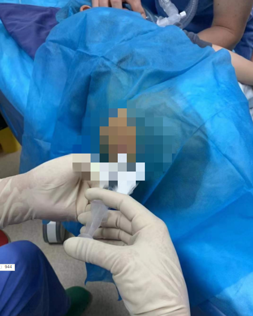 昔日“天價藥”納入醫(yī)保云南省首例“諾西那生鈉注射液”治療在省一院完成（云南省第一人民醫(yī)院供圖）