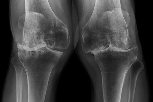 94c69122e51c234f1fd30a