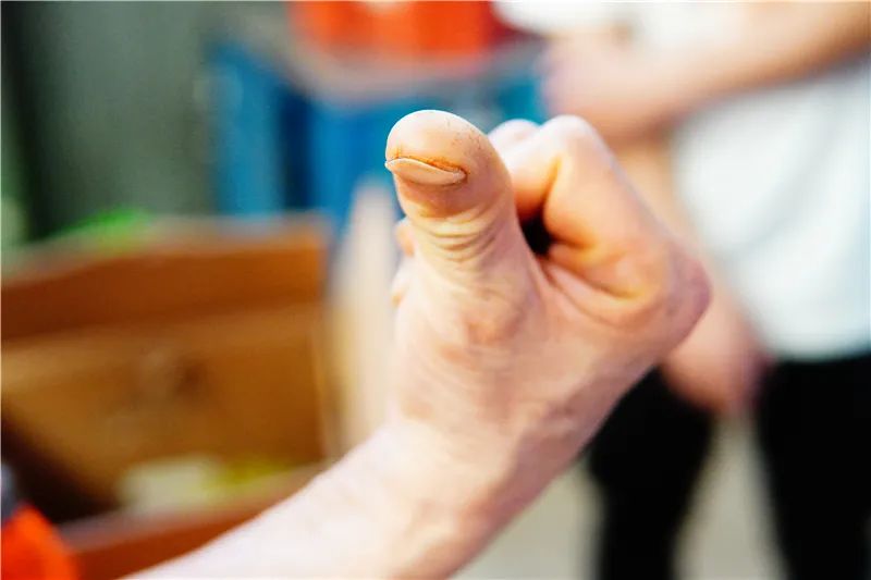 驗(yàn)果師邵一超多年驗(yàn)果留下的老繭.JPG 圖片